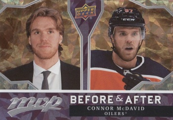 Connor McDavid Edmonton Oilers Upper Deck MVP 2021/22 Before and After #BA-2